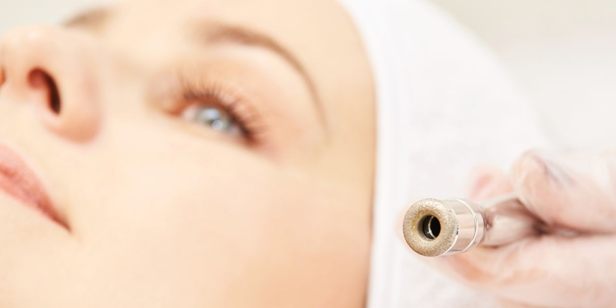 Microdermabrasion