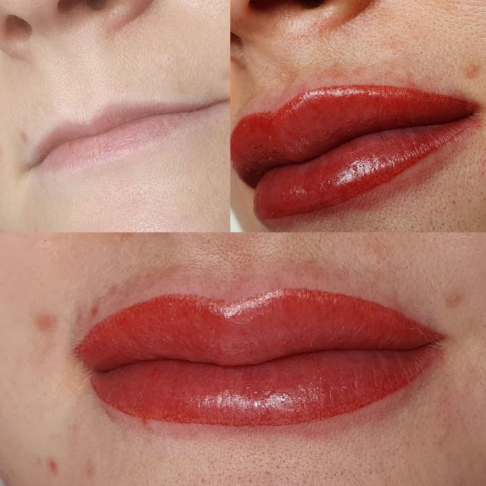Lippen